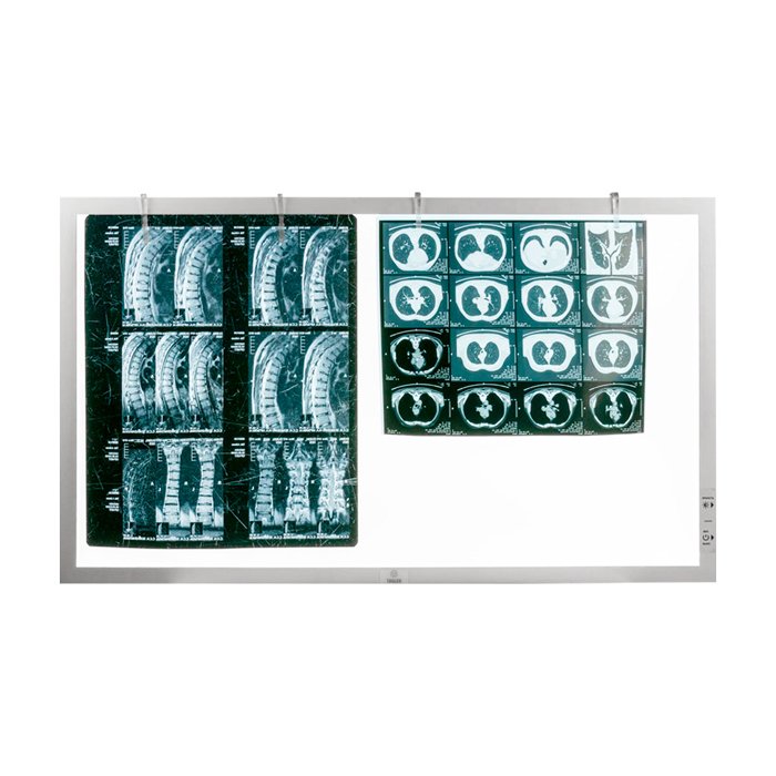 Негатоскоп светодиодный ТАГЛЕР НСД-2 (2-кадровый)