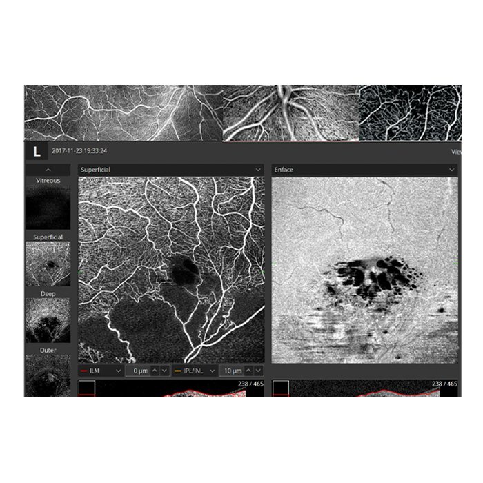 Томограф спектральный оптический когерентный, вариант исполнения: НОСТ-1, HUVITZ