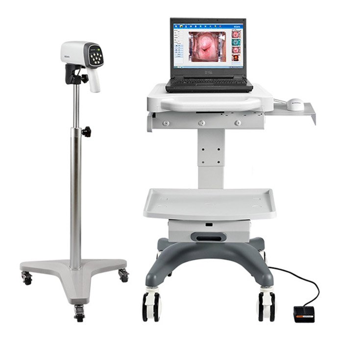 Видеокольпоскопы С6 HD/С6A HD, Edan