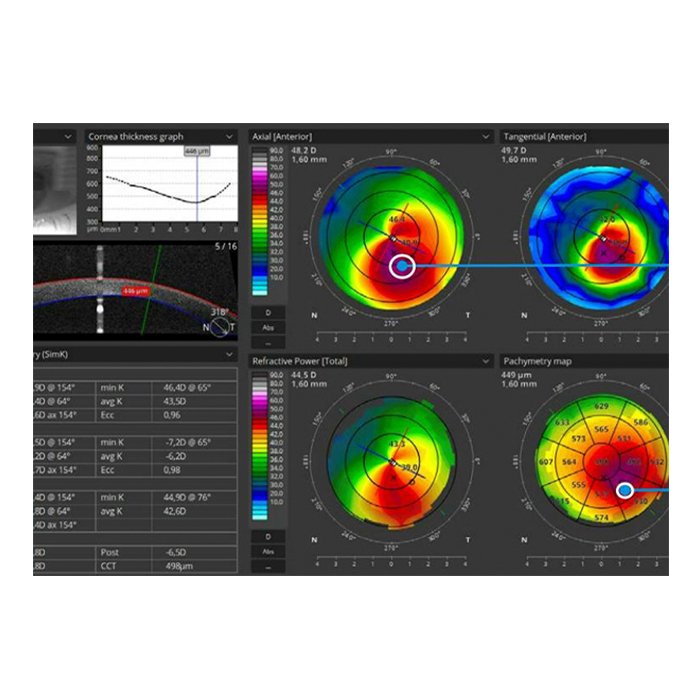 Томограф спектральный оптический когерентный, вариант исполнения: НОСТ-1, HUVITZ