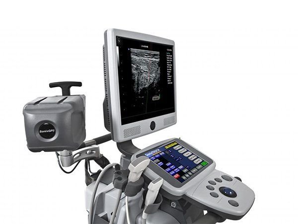 Sonix TOUCH УЗИ сканер, Ultrasonix Канада