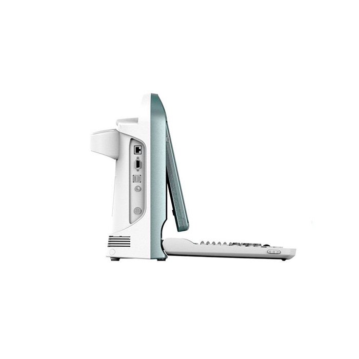 УЗИ сканер SonoTouch 50 Chison