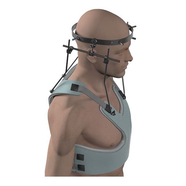 Аппарат "Halo-cast "ЦИТО"-S (малый размер)