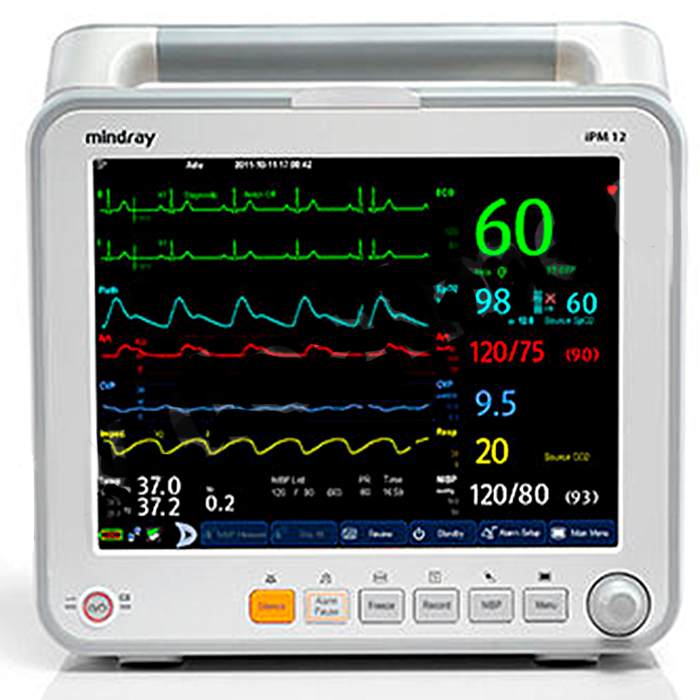 Монитор пациента Mindray iPM 12