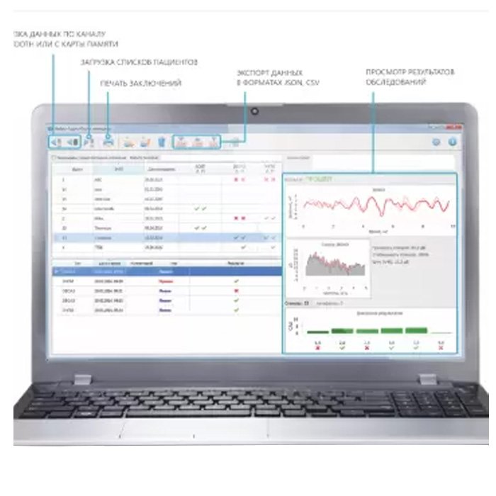 Система регистрации отоакустической эмиссии «Аудио-СМАРТ»