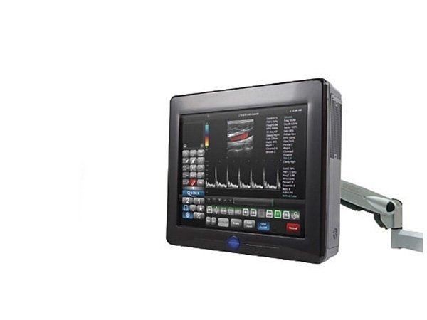 Sonix TABLET УЗИ сканер, Ultrasonix Канада