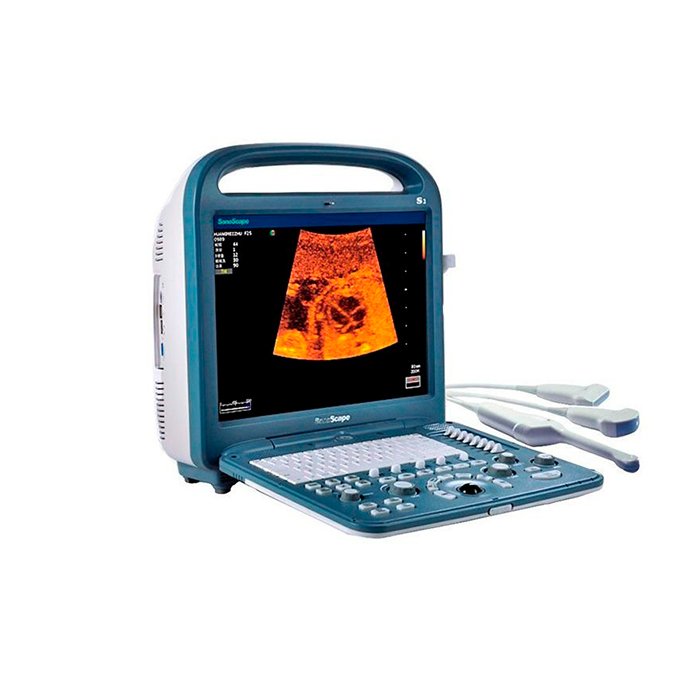 Ультразвуковой сканер S2 SonoScape