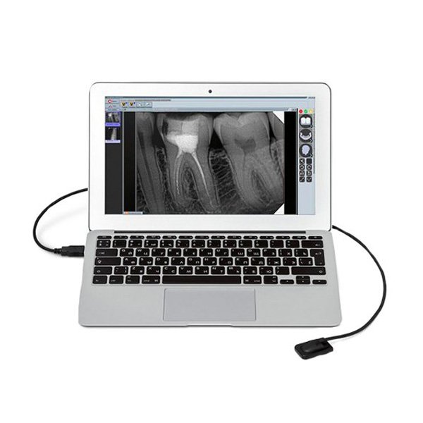 Радиовизиограф Mercury Digisens