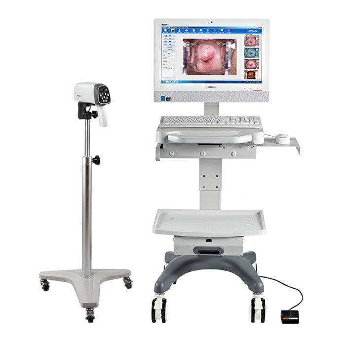 Видеокольпоскопы С6 HD/С6A HD, Edan