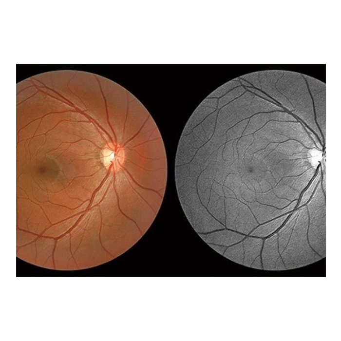 Томограф спектральный оптический когерентный, вариант исполнения: НОСТ-1, HUVITZ