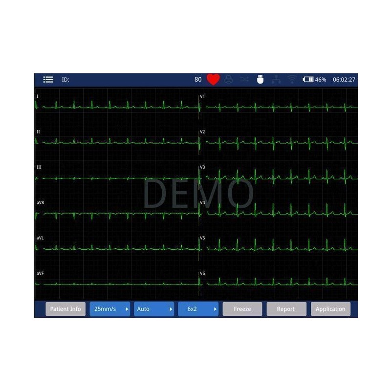 Электрокардиограф IMAC-1200