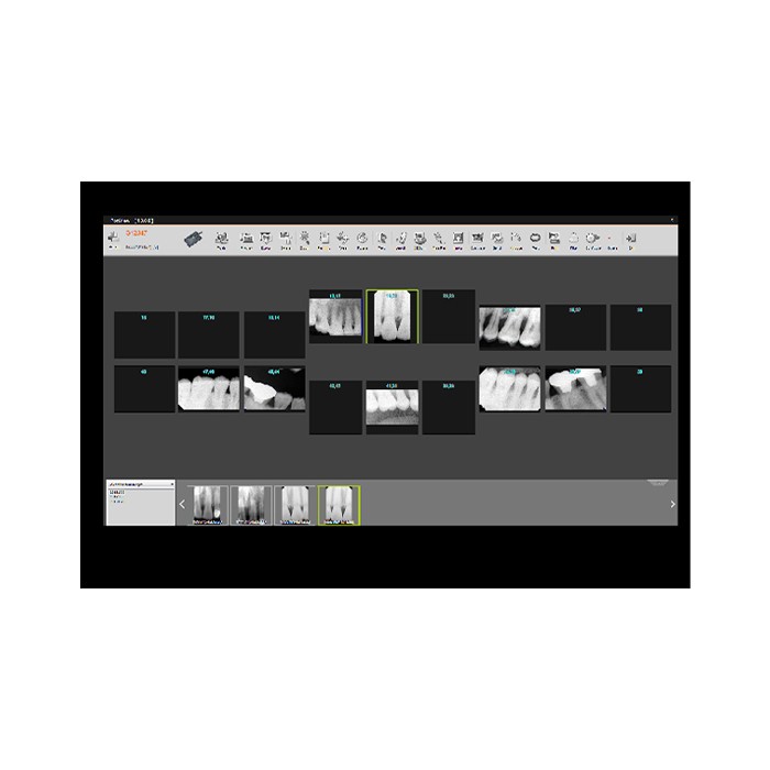 Genoray X-RAY SENSOR E9525 - радиовизиографическая система