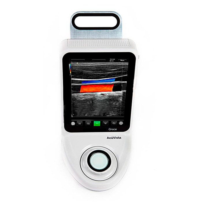 УЗИ-сканер AcuVista Grace