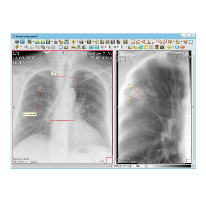 Информационная система АПК АрхиМед PACS/RIS