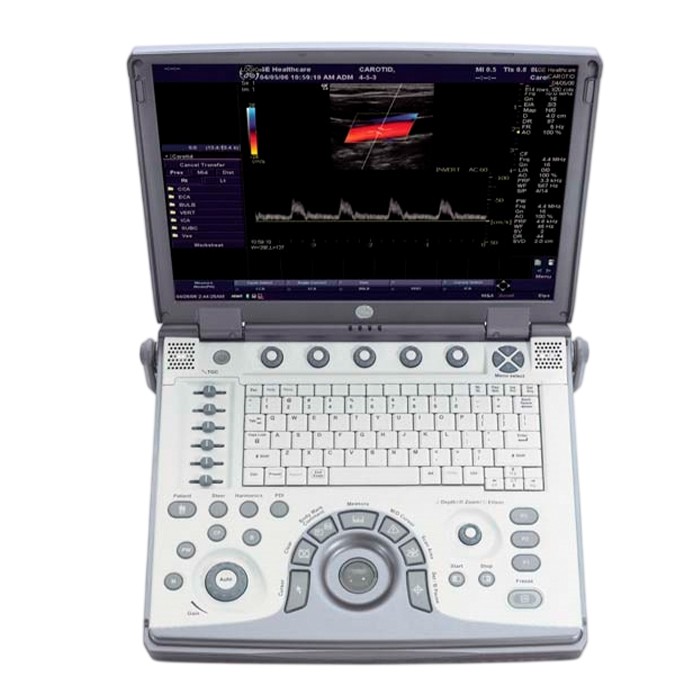 Портативный ультразвуковой аппарат GE Healthcare Voluson E