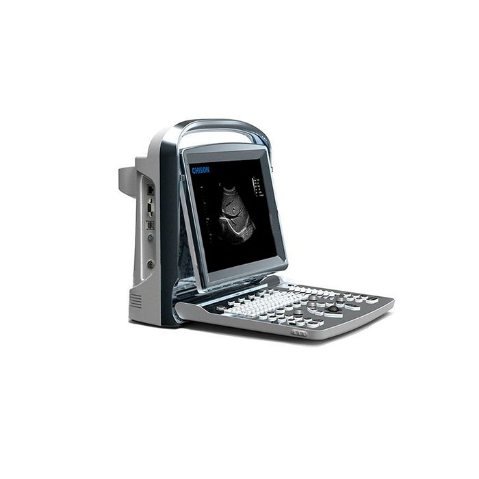УЗИ сканер SonoTouch 10 Chison