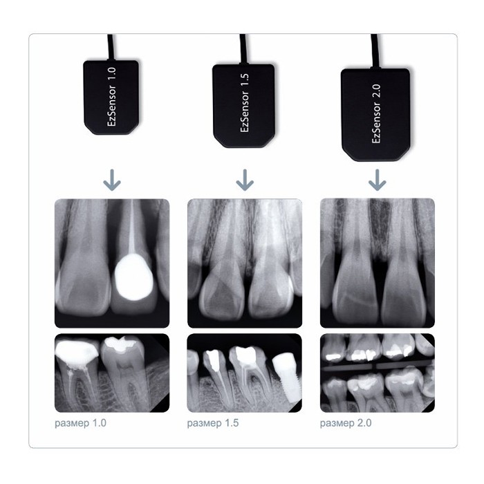 Vatech EzSensor - цифровой радиовизиограф