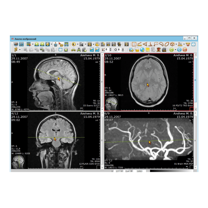 Информационная система АПК АрхиМед PACS/RIS