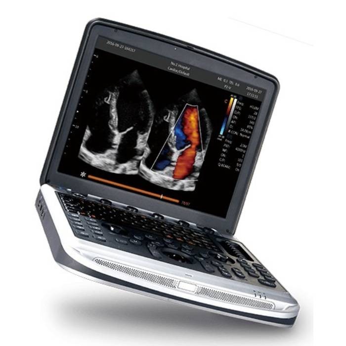 УЗИ аппарат Chison Sonotouch 80 (SonoBook 8)