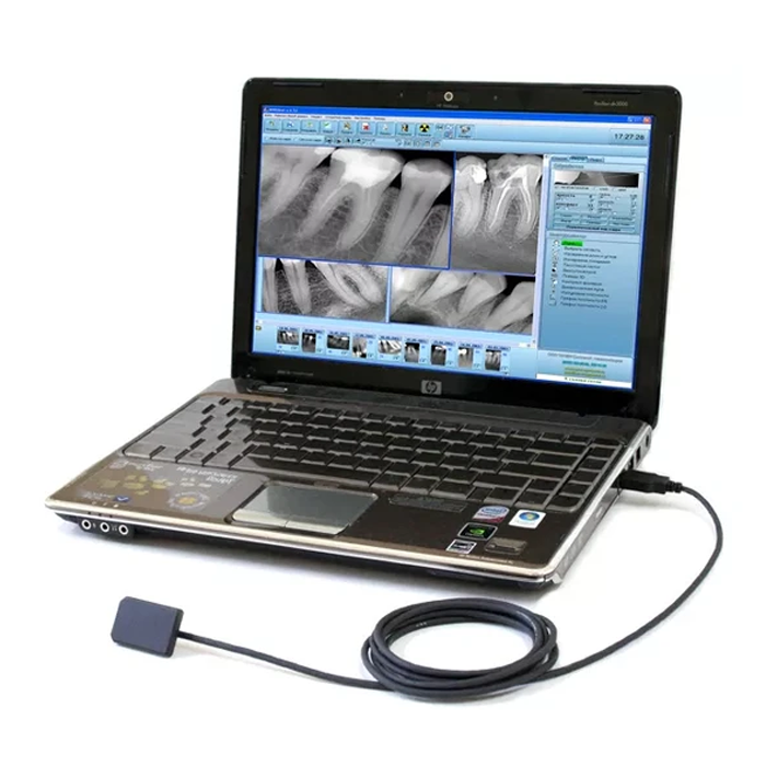 Анвизиограф - цифровой радиовизиограф