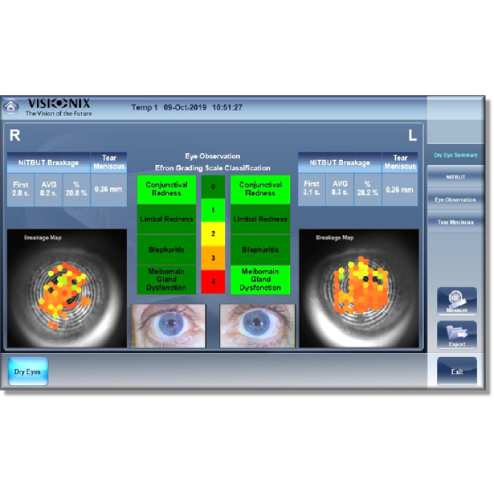 Авторефрактометр VX120+ DRY EYE
