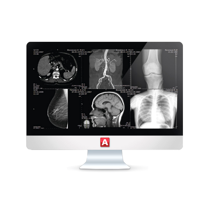 Информационная система АПК АрхиМед PACS/RIS