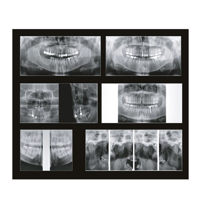 Papaya 3D Plus 16x8 - компьютерный томограф с цефалостатом