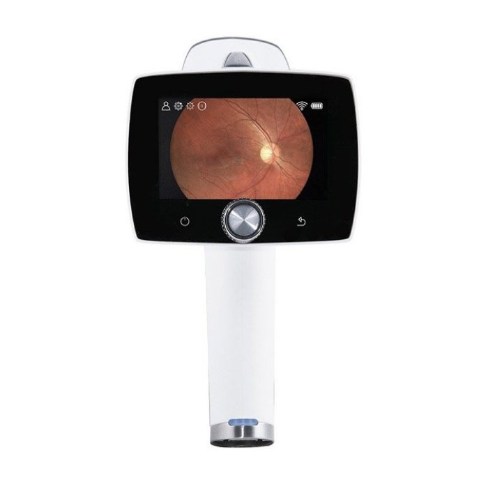 Ручная цифровая ретинальная камера AURORA, Optomed