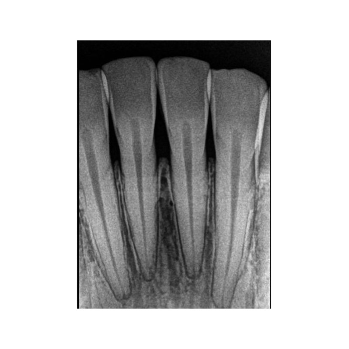 Carestream Dental RVG 5200 - радиовизиограф, 16 пар линий/мм