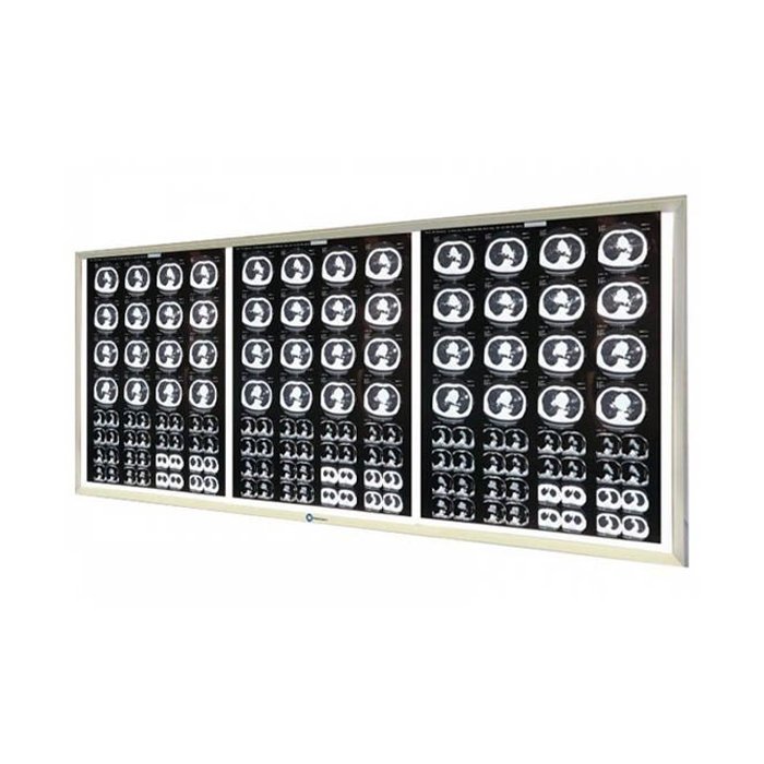 Негатоскоп LED на 3 снимка