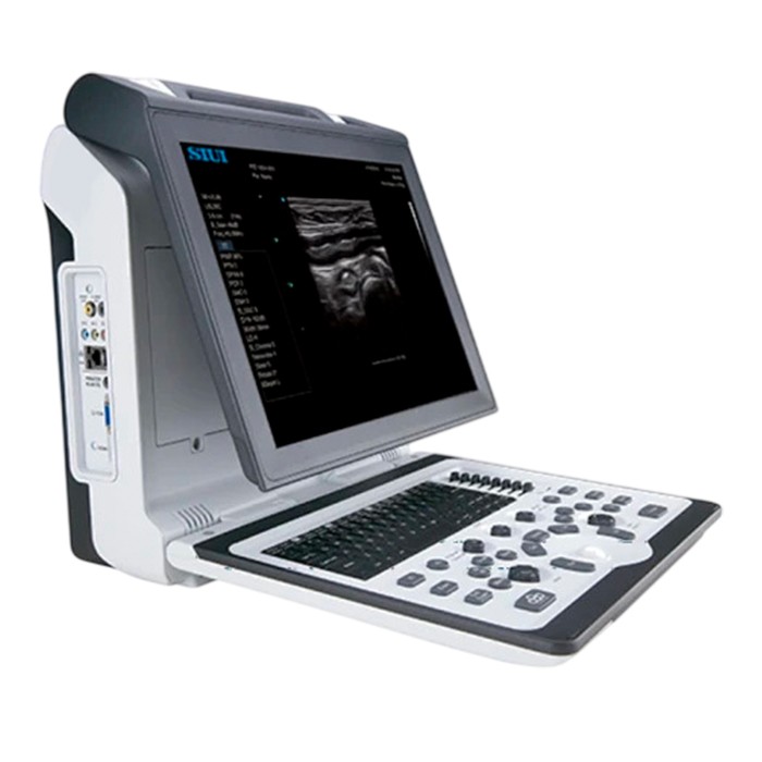 Ветеринарный аппарат УЗИ SIUI Apogee 2300V