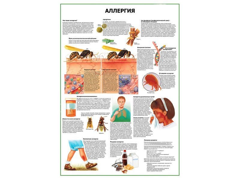 OLD Аллергия плакат глянцевый А1/А2 (глянцевый A1)
