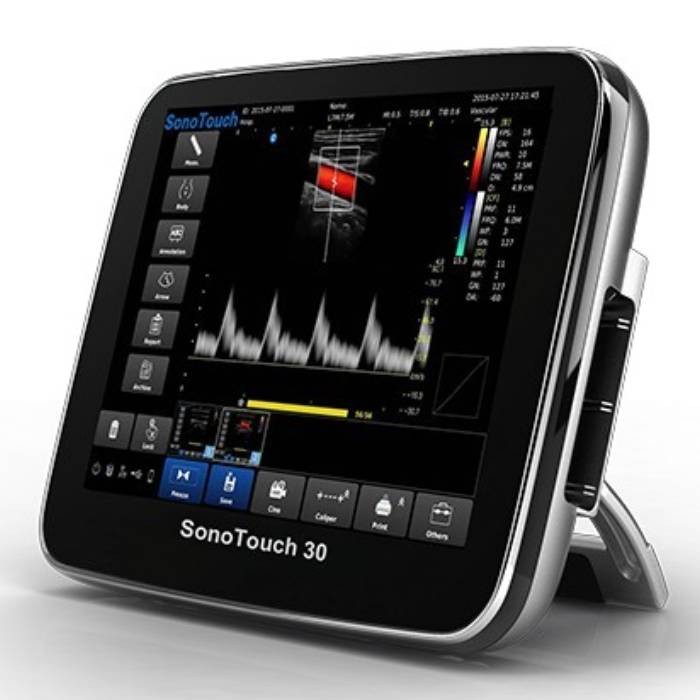 УЗИ аппарат Chison Sonotouch 30 (ECO 3)