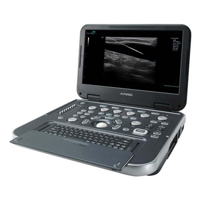 Ультразвуковой сканер E-CUBE i7 Alpinion