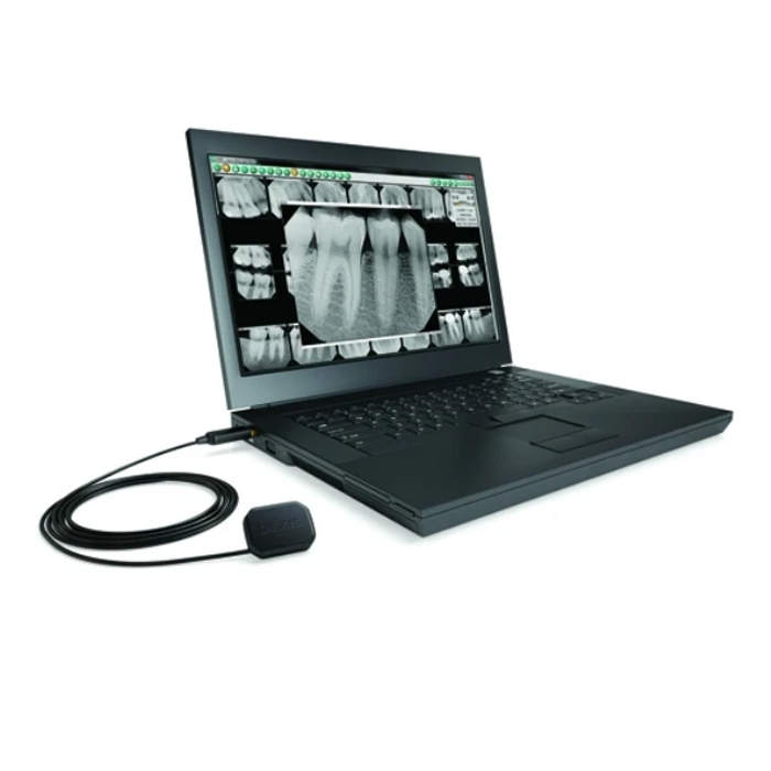 DEXIS Platinum - портативная цифровая рентгенографическая система