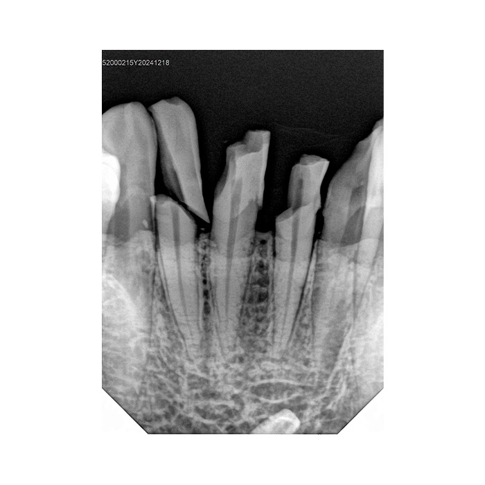 Handy HDR-380 - радиовизиограф