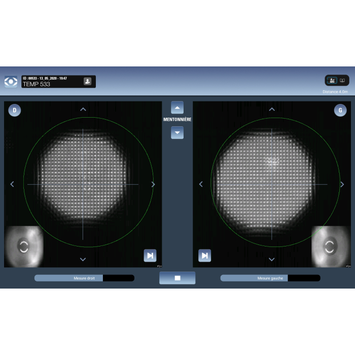 Автоматическая система для аберрометрии EyeRefract