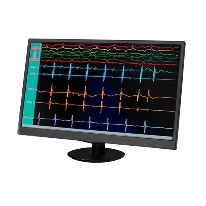 Комплекс аппаратно-программный для картирования сердца, диагностической и лечебной электрокардиостимуляции и радиочастотной деструкции проводящих путей сердца «ЭЛКАРТ-2», Lorge Medical