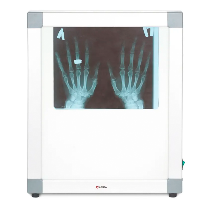 Армед 1726301 - негатоскоп 1-кадровый, светодиодный