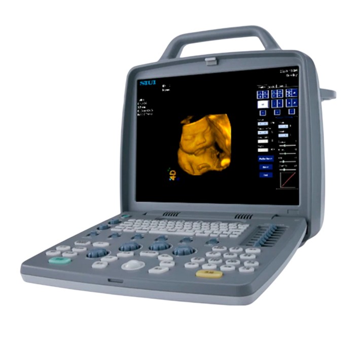 Портативный УЗИ аппарат SIUI CTS-8800 Plus