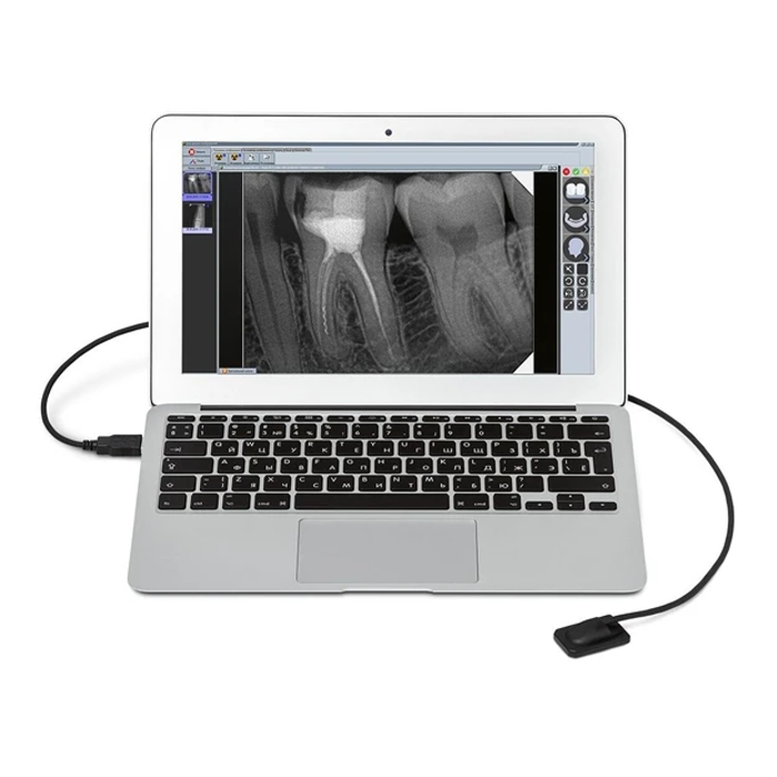New Life Radiology Mercury DIGISENS - цифровой радиовизиограф
