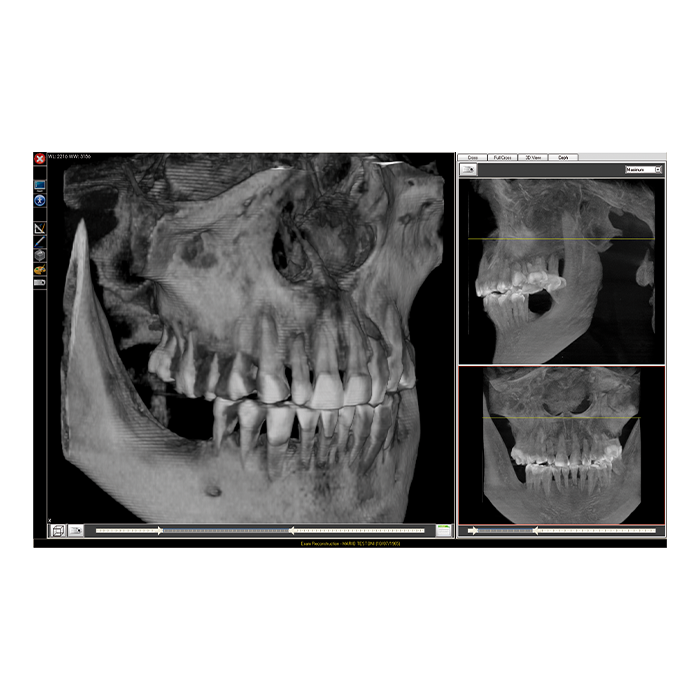 Fona XPan 3D - рентгенографическая цифровая система панорамной съемки