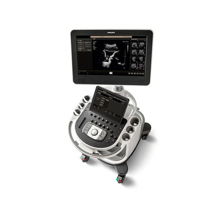 УЗИ аппарат Affiniti 70 Philips