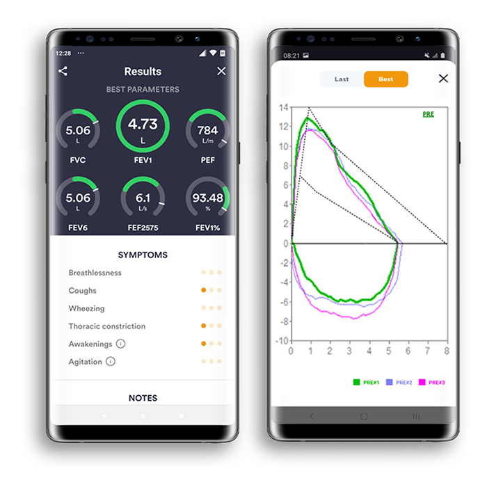 Аппарат для спирометрии MIR в исполнении Spirobank Smart с принадлежностями