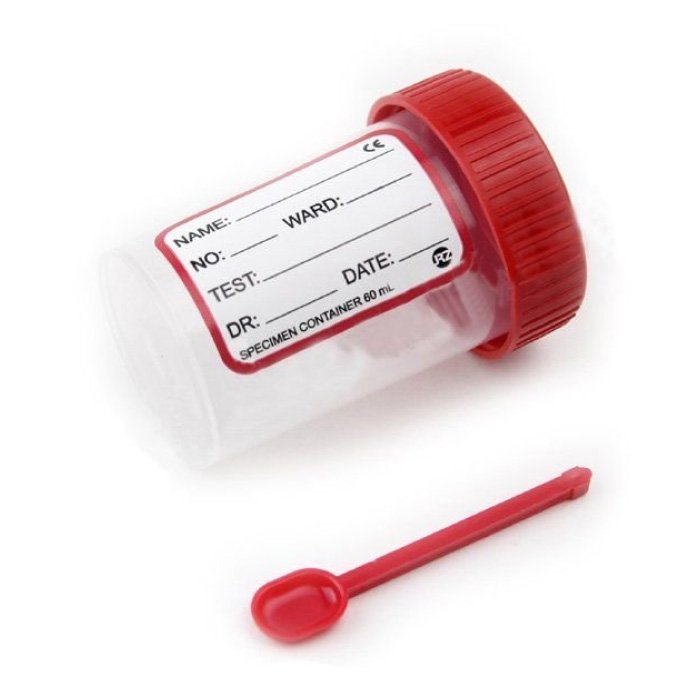 Контейнер для сбора 60 мл с встроенной лопаткой НЕСТЕРИЛЬНЫЙ