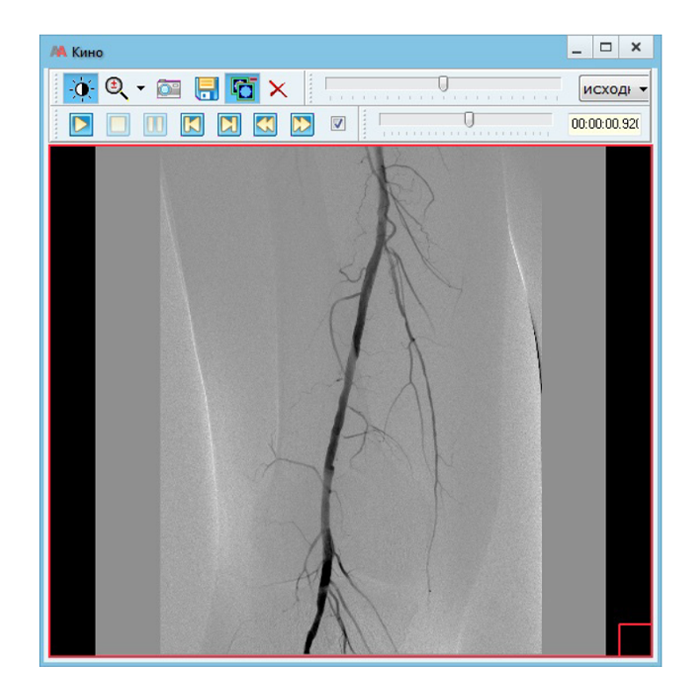 Информационная система АПК АрхиМед PACS/RIS