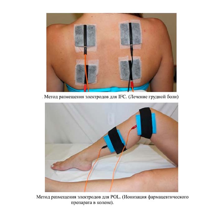Аппарат для электротерапии и электростимуляции Ibramed Neurodyn (6 каналов)