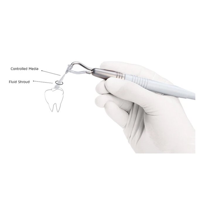 Пластиковые насадки для наконечника AquaCare (50 шт), Velopex