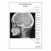 Рентгенография черепа. Вид сбоку плакат глянцевый А1+/А2+ (глянцевая фотобумага от 200 г/кв.м, размер A1+)