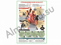 Стенокардия или инфаркт плакат ламинированный А1/А2 (ламинированный A2)